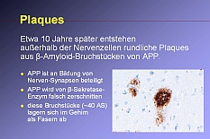 Ablagerungen im Gehirn: ß-Amyloid bildet Protein-Plaques.